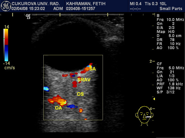 doppler ultrasonografi görüntüleri Şekil 2.