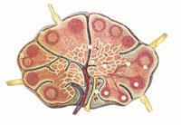 nodüllerinde fibrozis ve mediastinal lenf nodüllerinde pigmentasyon görülebilir. 1 