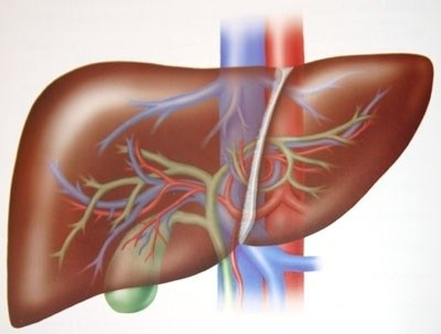 TIPS TIPSS, Transjugular Intrahepatic Porto-Systemic Shunt.