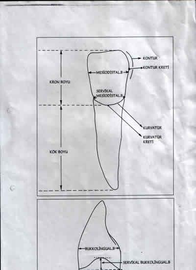 kontur kreti -distal yüzeyin kontur kreti arası 4) Kron serviks mesodistal boyutu: kron ve kökün mesial yüzeydeki birleşim yeri-distal yüzeydeki birleşim yeri arası 5) Kron bukkolingual boyutu: