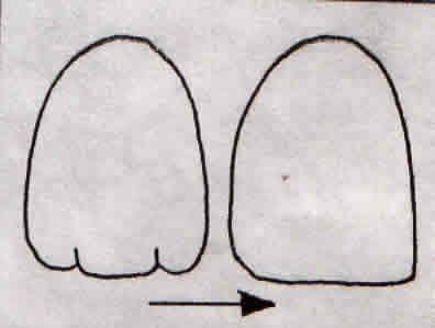 SÜREKLI ÜST KESERLER Sürekli üst keserler 4 adettir: 2 Santral ve 2 Lateral. Santral dişler orta hattın 2 yanında mesiallerinden birbirleri ile temas kurarlar.
