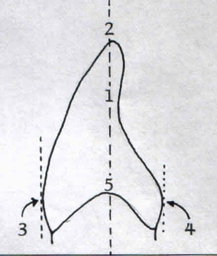 şeklindeki lateral formudur. Ayrıca singulum bozuklukları ve aşırı gelişmiş "pit" bu dişte görülebilen diğer gelişim bozukluklarıdır. LABIAL GÖRÜNÜM 1. Üst santrala benzer 2.