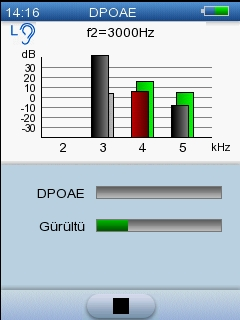 5 Alpha OAE ile test Çocuk Modu etkinleştirilmemişse, çubuk grafik görüntülenir. Çubuk grafik ve görüntülenen diğer verilerin açıklaması için aşağıdaki Test detayları tablosuna bakın.