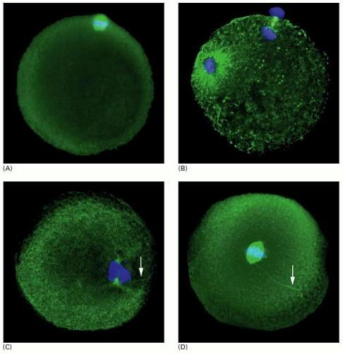 İnsanda in vitro