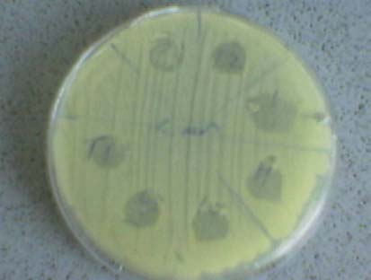 coli 24 saat sonra (bakteri/ml) PU HMDI 0 Pb/Co, Ca/Co 0 PU HMDI 0 Ca 0 PU HMDI 0 0/0 0 PU HMDI 0.5 Pb/Co 0 PU HMDI 1.0 Pb/Co 0 PU HMDI 1.5 Pb/Co 0 PU HMDI 2.0 Pb/Co 0 PU HMDI 3.0 Pb/Co 0 PU HMDI 10.