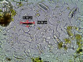 Tetraploid olduğu düşünülen bitkiler stoma yoğunluğu (81.76 adet/mm² ile 119.