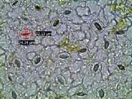 AB 267 hattında tetraploid bitki ile diploid bitkilerinde stoma yoğunluğu Şekil 4.14 de gösterilmiştir. Çizelge 4.48.