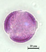 poleni (X100) Şekil 7. Carduus spp.