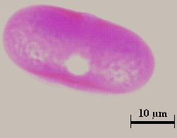 Brassicaceae familyasından Tip 2 poleni