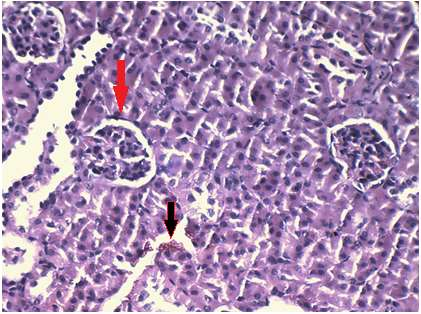 SABAH, ÇAVUŞOĞLU, DEMİRTAŞ, YAPAR, YALÇIN Şekil 2. Fenpiroksimat uygulama grubunda böbrek hücresinin görünümü [hyalin cast (kırmızı ok), nekroz (siyah ok)]. Boyama: Hematoksilen-Eosin. Büyütme: 500X.