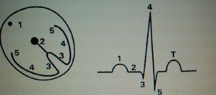 Depolarizayonun EKG dalgaları ile olan ilişkisi 1.