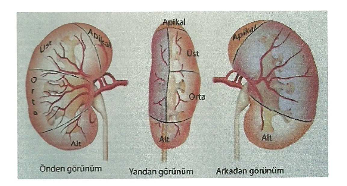 değerlendirilen hastalarda, nadiren de olsa böbreğin posteroinferiorunda, hatta retrorenal kolon saptanabilir. Bu vakalara yapılan perkütan girişim esnasında bağırsak yaralanma riski çok artmıştır.