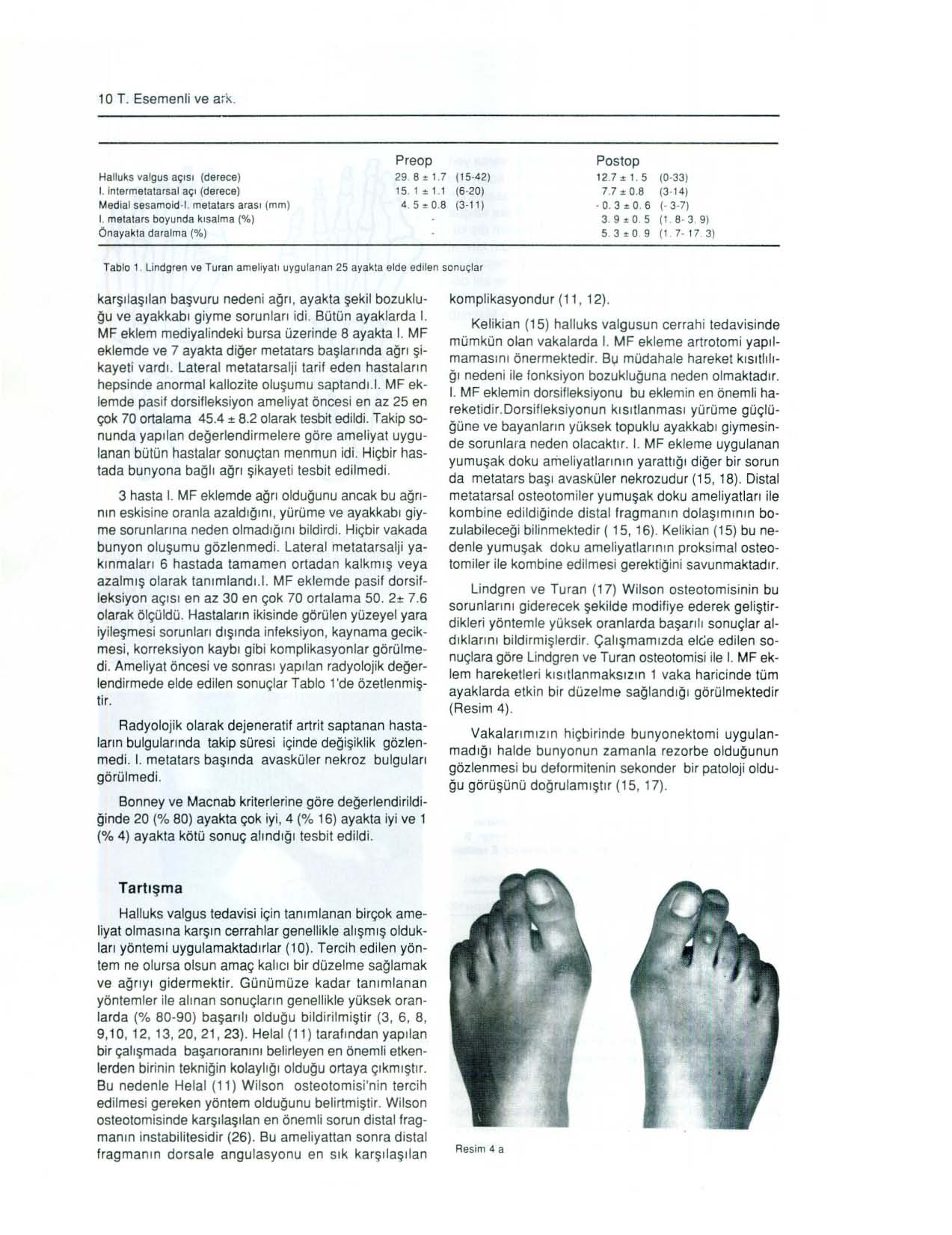 lot. Esemenli ve ark. Halluks valgus açısı (derece) i. intermelatarsal açı (derece) Medial sesamoid-i. metatars arası (mm) i. metatars boyunda kısalma (%) Önayakla daralma (%) Preop 29. 8 ± 1.