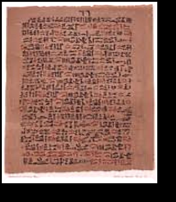 EBERS papirusu MÖ-1550 Eski Mısır da diyabetin bir böbrek hastalığı