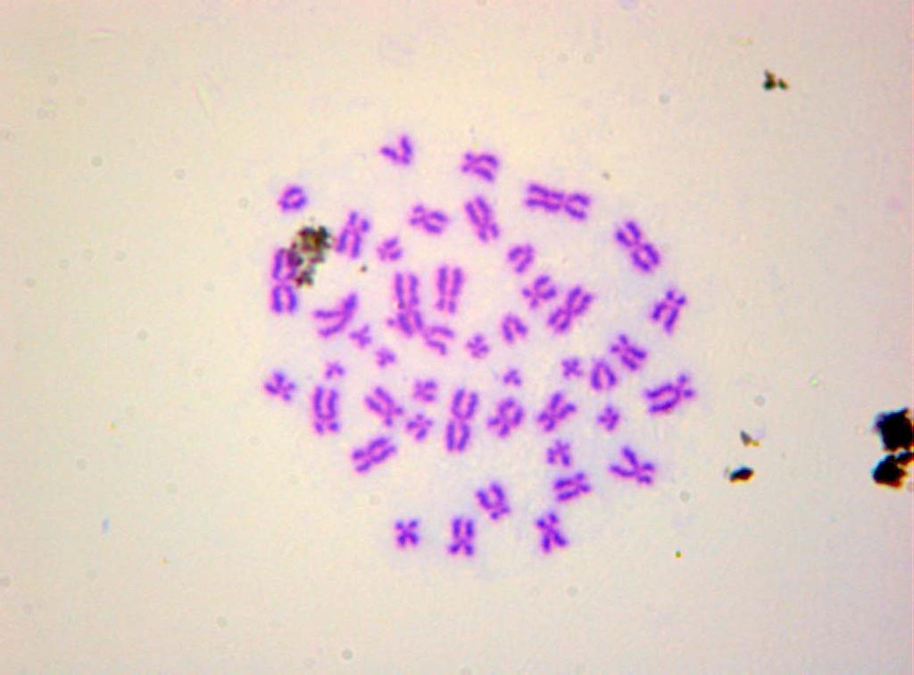 gözlenen kromozom anormallikleri a) kromatid kırığı b) kromozom