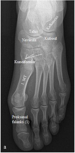 anatomik bölgeye uygun x-ışını dozu kullanılmaya başlanmış ve bu sayede