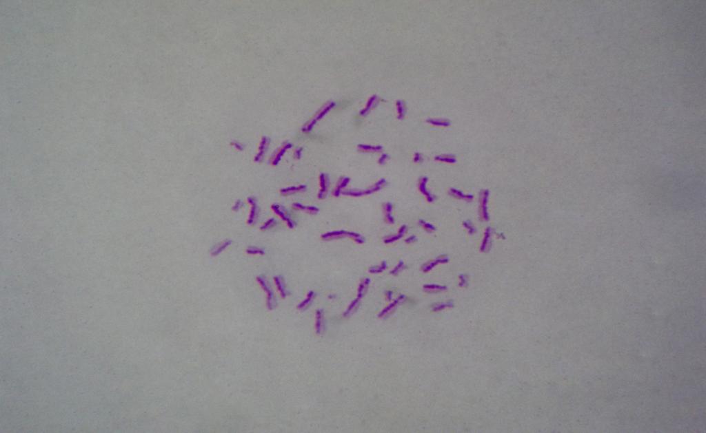 4. BULGULAR Erman Salih İSTİFLİ 10 µm Şekil 4.18.