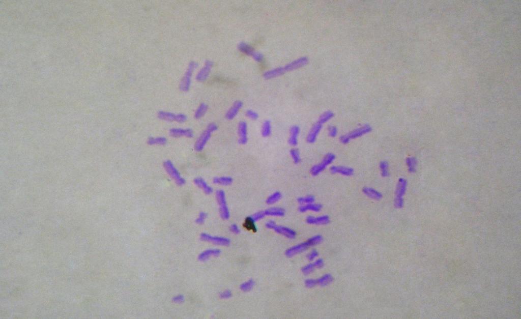4. BULGULAR Erman Salih İSTİFLİ 10 µm Şekil 4.24. Disentrik kromozom (DS) bulunan metafaz plağı (1000 µg/ml Amoxicillin + S9 mix, 3 
