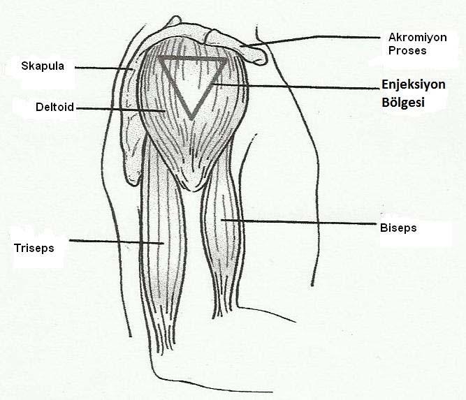 Şekil 1. Deltoid Kası İntramüsküler Enjeksiyon Bölgesi Kaynak, Rios C.J. Injections. Essential Clinical Procedures. Second Edition. Elsevier 20