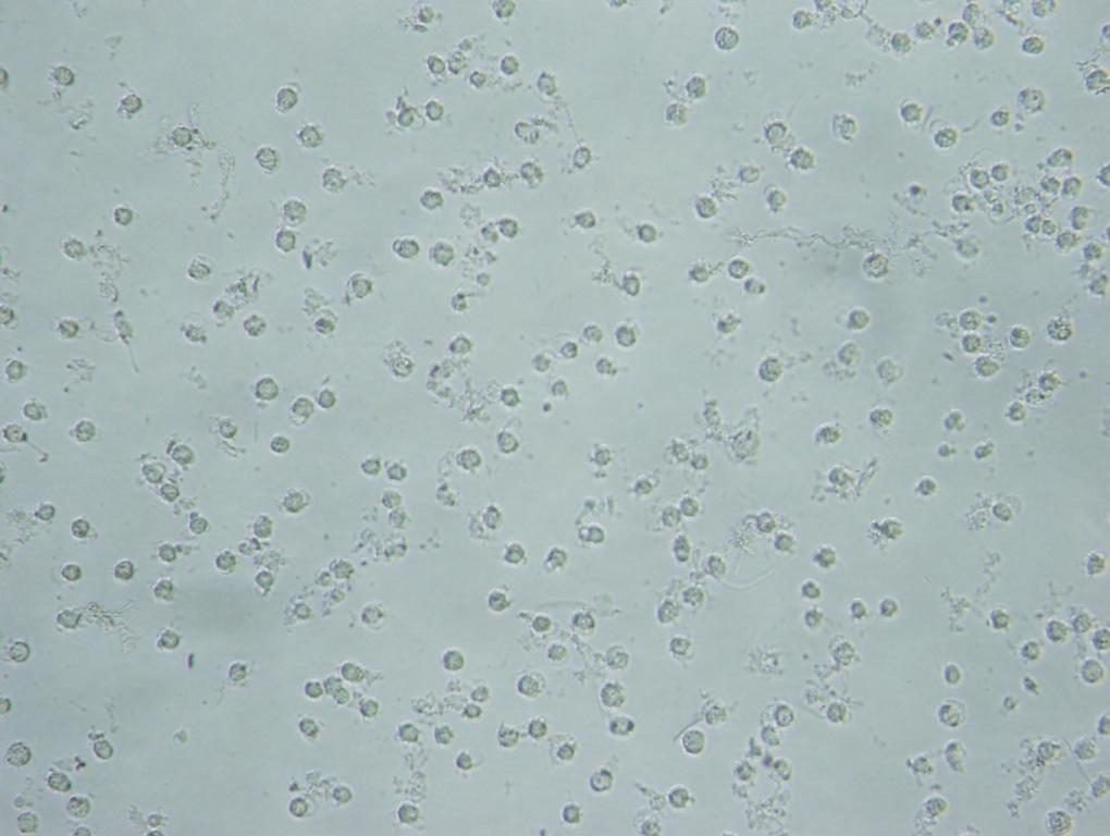 L929 hücrelerinde oluşturduğu morfolojik değişimlerin