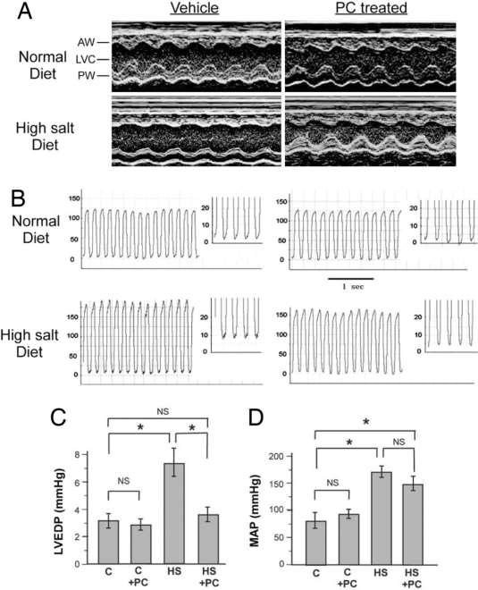 Parikalsitol yüksek sodyumlu diyetle ortaya çıkan sol ventrikül hipertrofisini azaltıyor: Tuz duyarlı farelerde Paricalsitol kullanımı ile sol ventrikül diyastol sonu basıncı düşüyor.