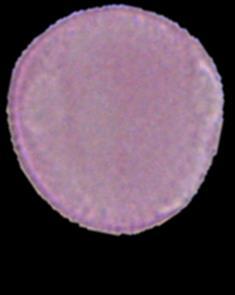 polenlerin mikrofotoğrafları
