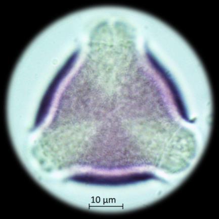 Apertür ve ornamentasyon e f Rosaceae e.