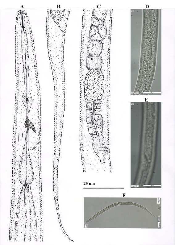 Şekil 4.23. A-F. B. gracilis. A-F. Dişi. A. Baş ve Oesophagus bölgesi; B.