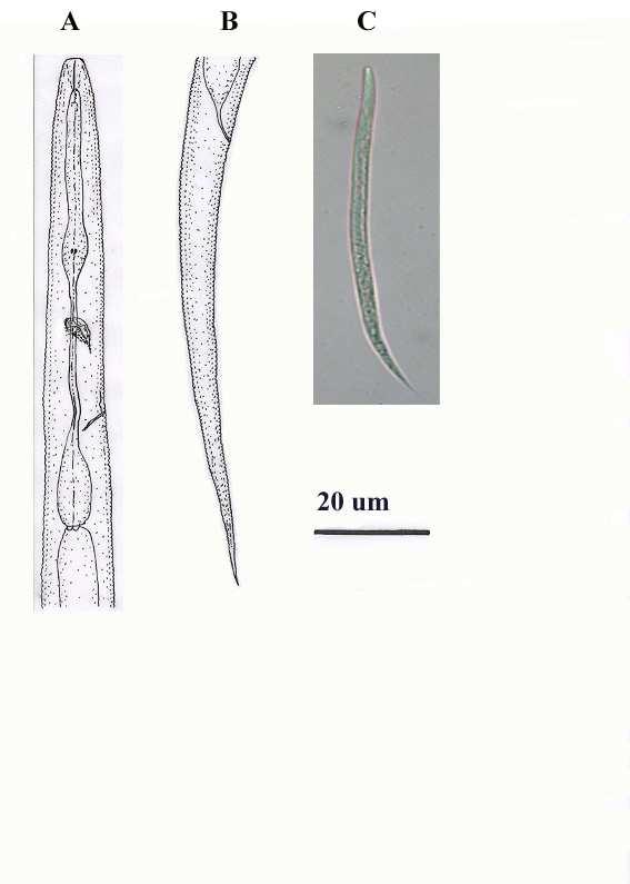 Şekil 4.27. A-C. Z. neonamus. A-C. Dişi. A. Baş ve Oesophagus bölgesi; B.