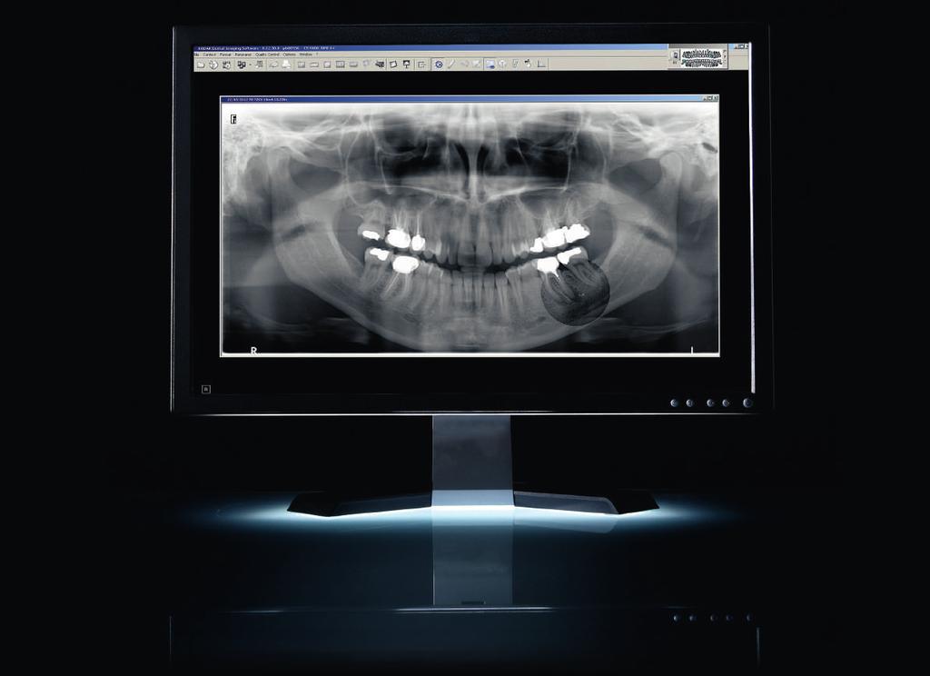 Sezgisel yazılım ve kolay paylaşım Kullanımı kolay araçlar ve gelişmiş iletişim Sezgisel dental görüntüleme yazılımımız, ister müstakil bir program olarak, ister klinik yönetim programınız ile