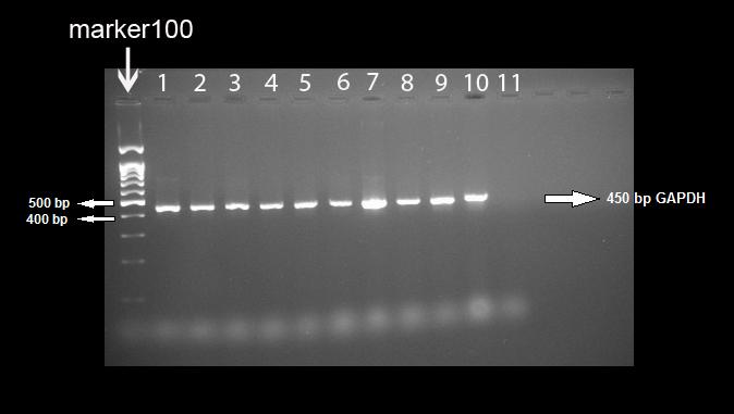4.2. enos ve GAPDH mrna Ekspresyonu PCR Sonuçları ve Dansitometrik Analizleri Şekil 6. GAPDH kontrol ve diyabet gruplarına ait PCR görüntüsü.