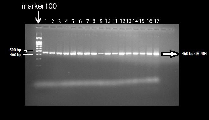 Şekil 8. GAPDH Resveratrol, Diyabetik-Res50, Res5-Diyabetik, Res50- Diyabetik gruplarına ait PCR görüntüsü.