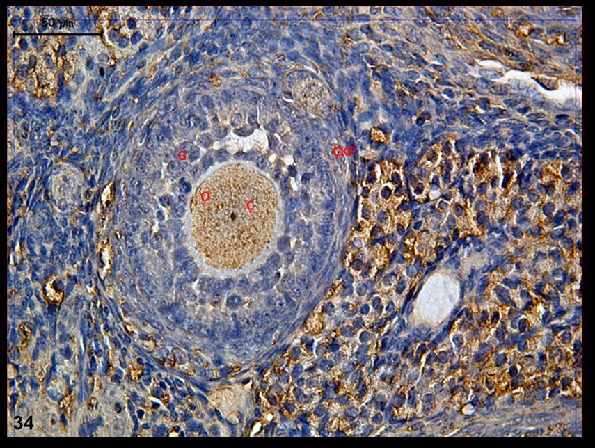 Resim 34: Klomifen sitrat uygulaması yapılan gruba ait gebe ovaryum dokusunda yapılan c-fos boyamasında tutulumun stromada