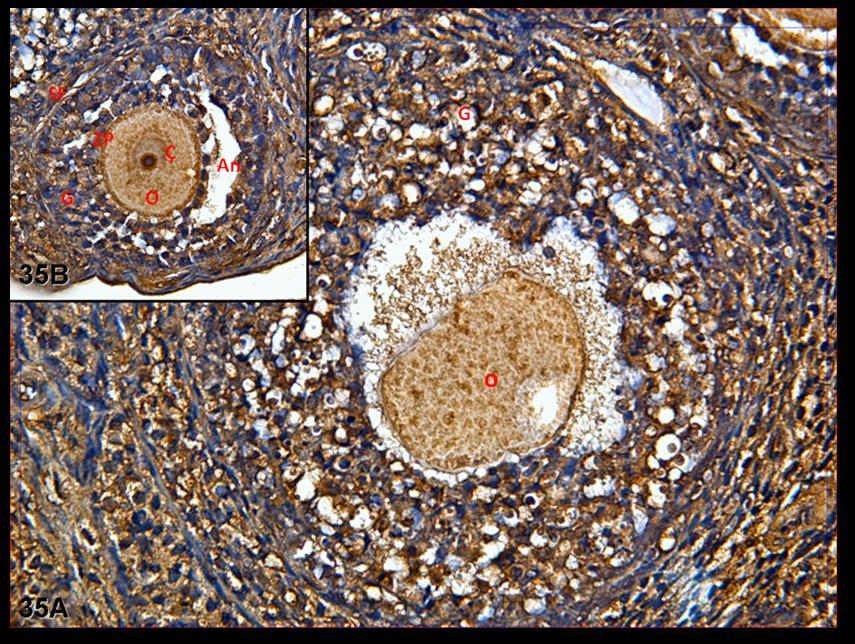 Resim 35A,B: Klomifen sitrat uygulaması yapılan gruba ait gebe ovaryum dokusunda yapılan c-fos boyamasında tutulumun sitoplazmada ve granüler şekilde olduğu