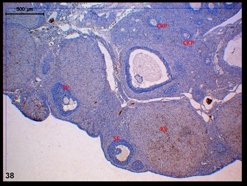 Resim 38: Hormon uygulaması yapılan gruba ait ovaryum dokusunda yapılan LIF boyamasında; immünreaktivitenin kontrol grubuna eşdeş olduğu