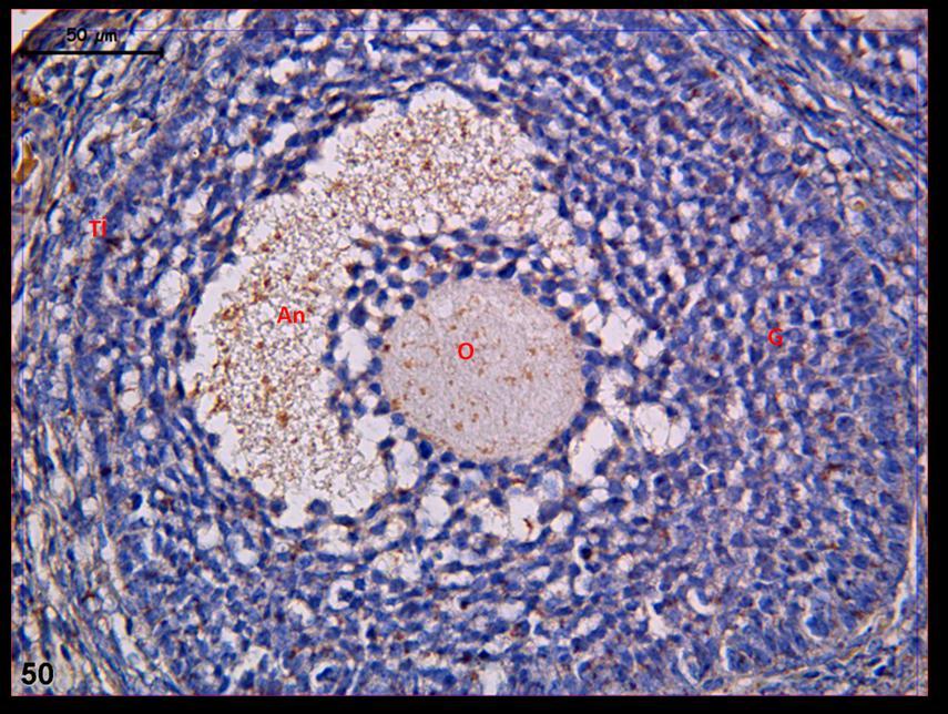 Resim 50: Klomifen sitrat uygulaması yapılan gruba ait gebe ovaryum dokusunda; sekonder folikülde granüloza hücrelerinde ve teka interna hücrelerinde LIF