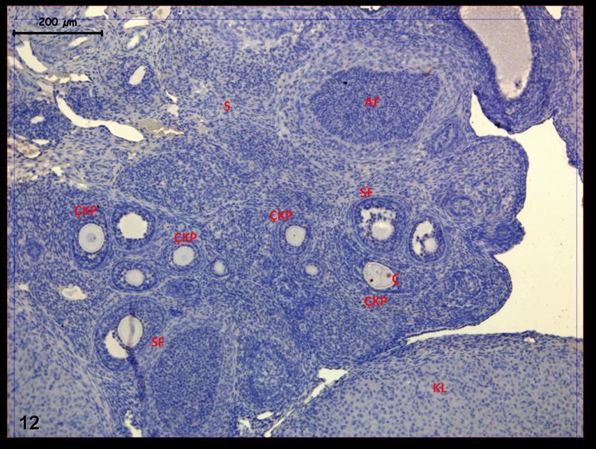 Resim 12: Klomifen sitrat uygulaması yapılan gruba ait ovaryum dokularında PCNA immünreaktivitesinin tüm folliküllerde, atretik olanlarda stromada ve korpus luteumda son derece az düzeyde
