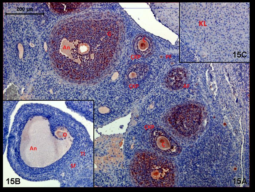Resim 15A,B,C: Klomifen sitrat uygulaması yapılan gruba ait gebe ovaryumlarında PCNA boyamasında tutulumun tüm folliküllerde granüloza ve teka interna hücreleri düzeyinde olduğu ayırt ediliyordu.