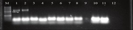 enfekteli oldu u dü ünülen 12 örne in RT-PCR sonras agaroz jel görüntüleri. ekil 4.