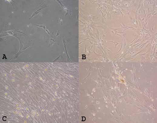 Çal ma için olu turulan iki tüpten birincisine CD105/CD73/CD34/CD45 ve ikincisine ise CD105/ CD166/CD34/CD45 konuldu, her tüpe 5x10 5 MKH süspansiyonu eklendi.