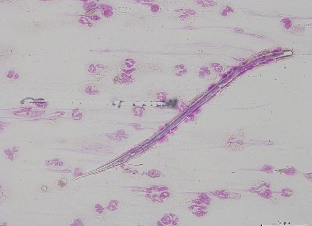 753 ÇETİNKAYA, AKYAZI ÖZKURT, MATUR Table 1. Results of serologic, PCR and microscopic examination assays for the detection of D.