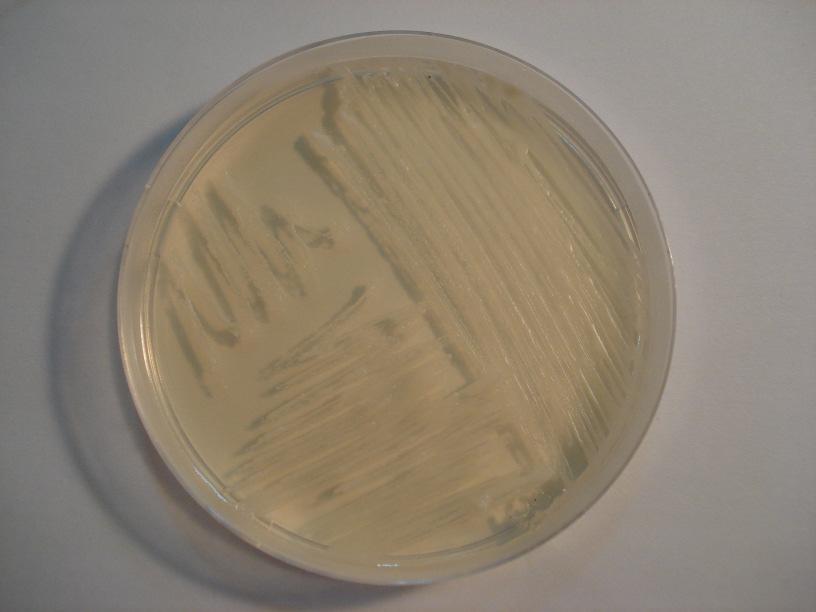 A B C D Resim 4.6: A. Candida albicans B. Üremiş Candida albicans kolonilerinin üzerine O- CAS besiyeri döküldüğü an C.