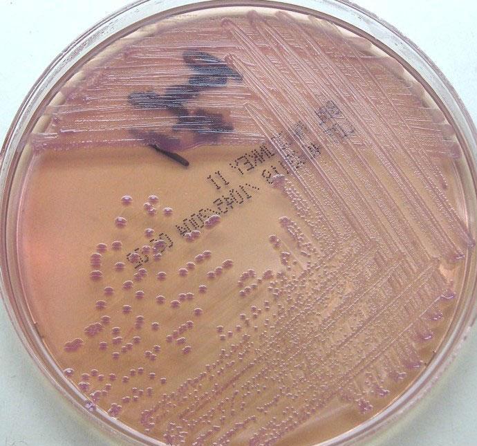 Ertesi gün Acinetobacter baumannii Mac Concey Agar Kenneth H.