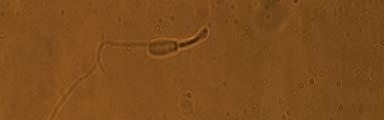 sahip spermatozoon (d). 2.7.2.4.