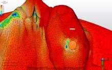 65 4.BULGULAR Çalışmamızda; 6 ayrı tasarımda, 3 farklı yükleme altında kemikte ve implantta görülen minimum principle stres (sıkışma stresi), maksimum principle stres bulguları incelendi.