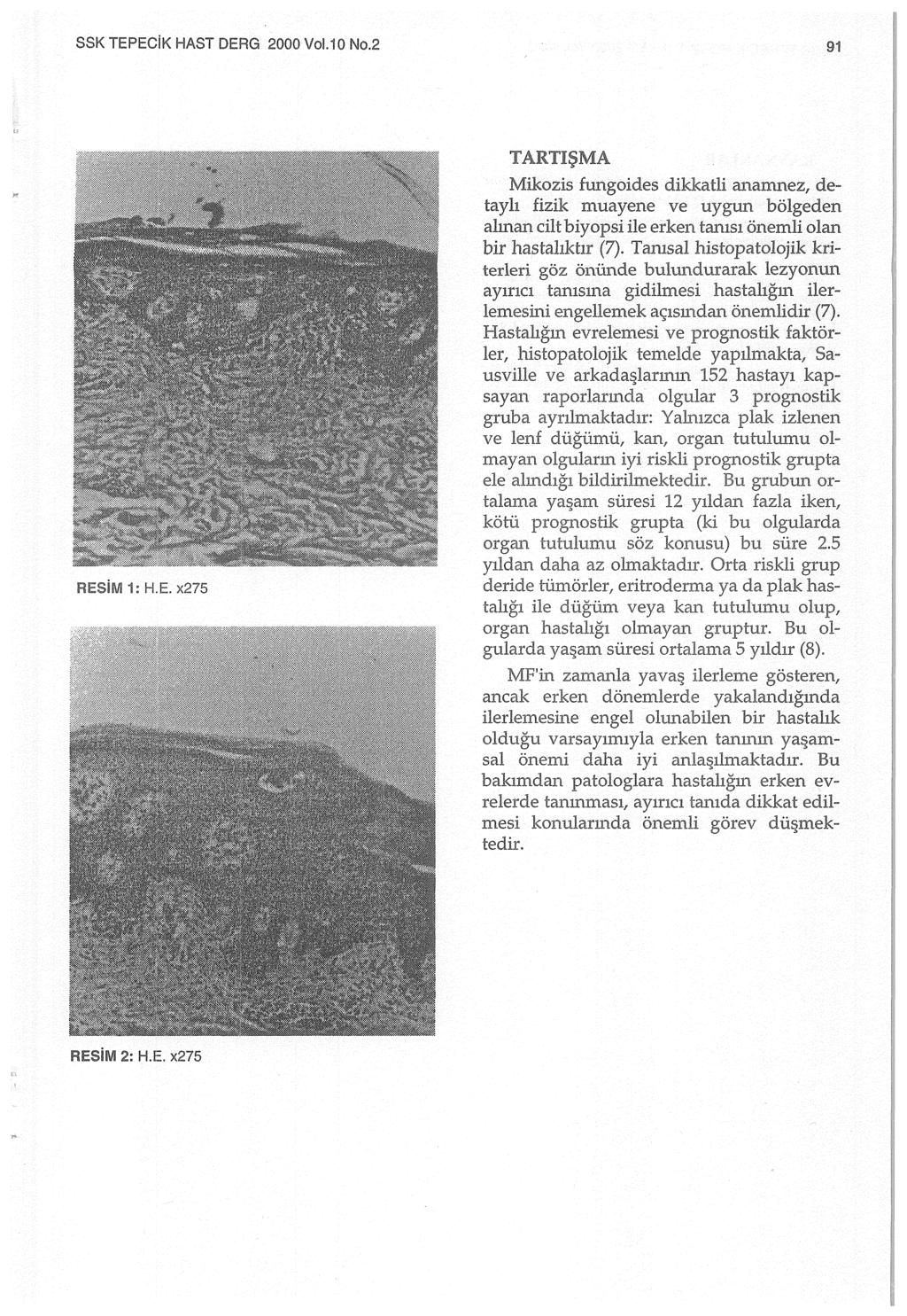 SSK TEPECiK HAST DERG 2000 Vol.10 No.2 91 RESiM 1: H.E. x275 TARTIŞMA Mikozi.