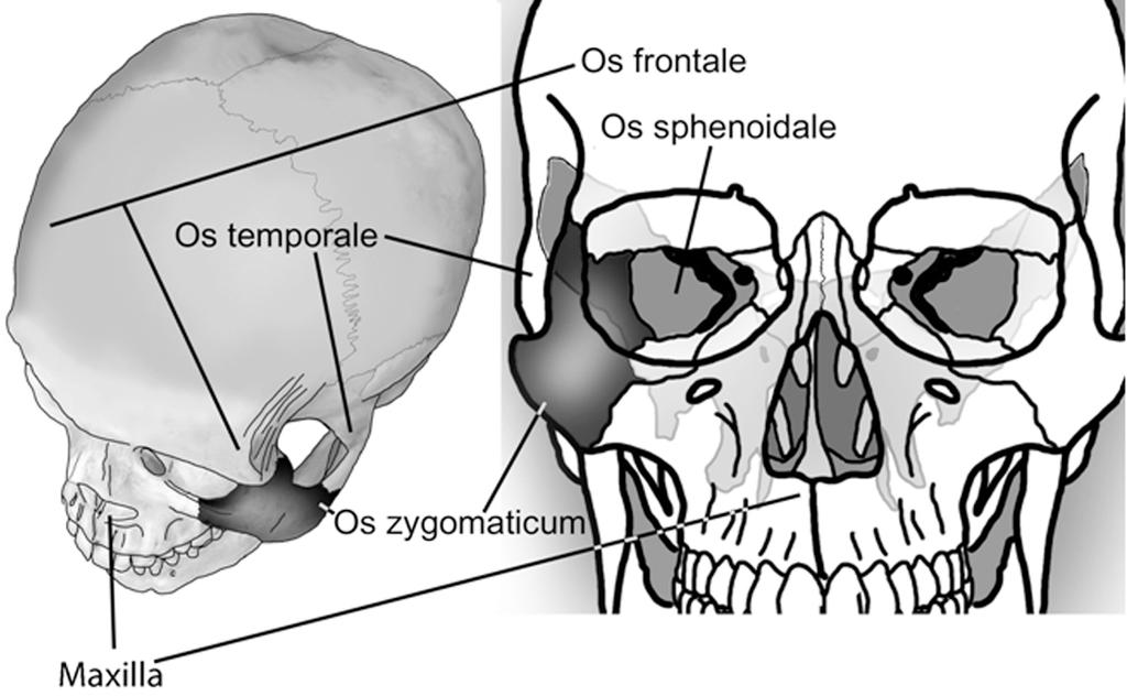 13 Os palatinum (damak kemiği) komşuluk 2 Os zygomaticum (elmacık kemiği) komşuluk Os zygomaticum; yanak