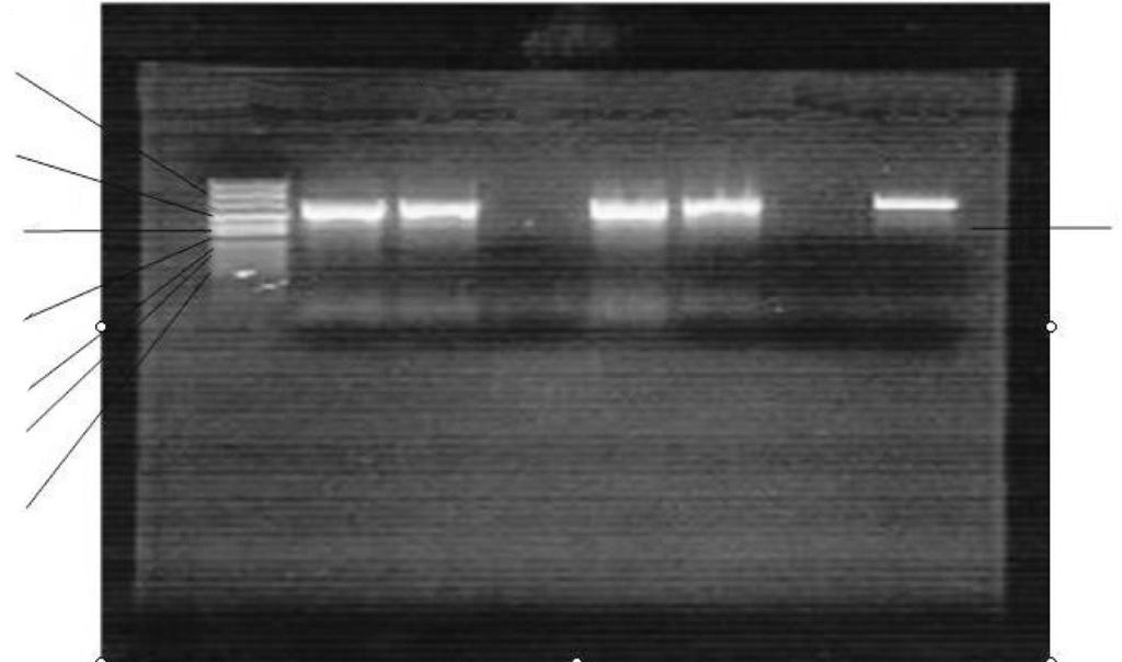 Hastane Kaynakl Pseudomonas aeruginosa zolatlar nda PER-1 Tipi Beta-Laktamaz S kl n n ve Antibiyotiklere Direnç Oranlar n n Araflt r lmas İzolatlarda PER-1 beta-laktamaz varlığı polimeraz zincir