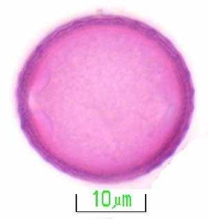 164 EK-1 (Devam) Adapazarı ballarında bulunan polenlerin mikrofotoğrafları a. b. c.