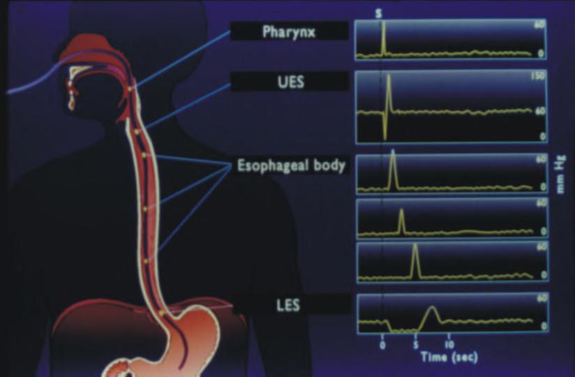 Farinks=0 mmhg Üst özofagus sfinkteri=100 mmhg Özofagus